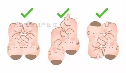 生雙胞胎一定要剖腹？記愛博恩雙胞胎妊娠媽媽的順產(chǎn)記錄